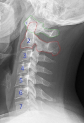 頸椎７個の椎骨